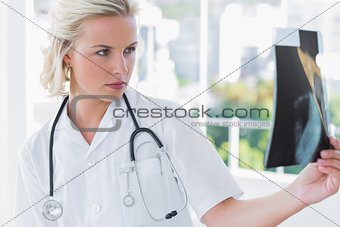 Nurse holding a radiography
