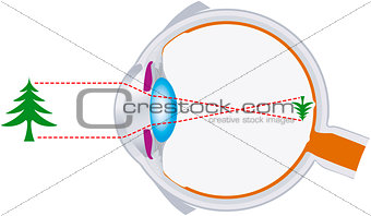 Eyeball Optics And Vision Lens System