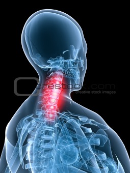 x-ray anatomy-neck inflammation