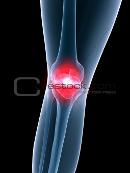 x-ray anatomy-painful knee
