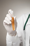 Doctor's hand with urine sample