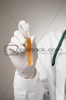 Doctor's hand with urine sample