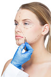 Surgeon drawing dotted lines on patients face