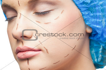 Close up on gorgeous young patient with dotted lines on the face