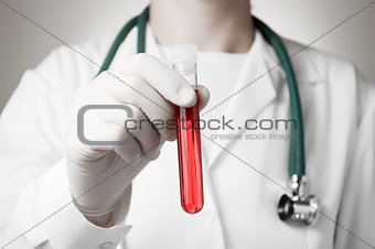 Doctor's hand with blood sample