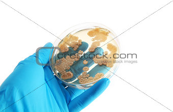 Penicillum fungi on agar plate