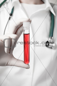 Doctor's hand with blood sample