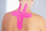 Close up of patients back with applied kinesio tape