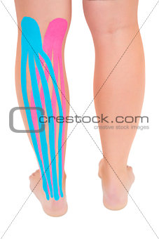 Patients leg with applied pink and blue kinesio tape
