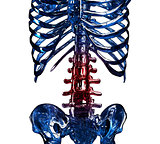 3D item of thoracic rib in pain