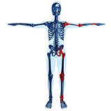 Full human glass skeleton 3D concept with joint pain on left sid