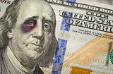 Black Eyed Ben Franklin on New One Hundred Dollar Bill