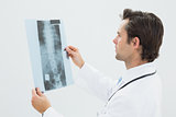 Concentrated male doctor examining spine x-ray