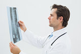 Concentrated male doctor examining spine x-ray