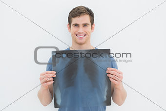 Portrait of a smiling young man holding lung x-ray