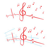 EKG of music