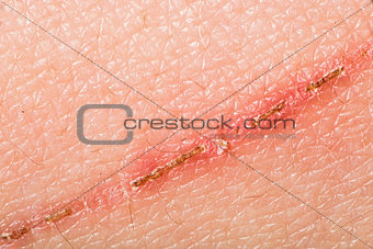 Texture of human skin and scratch