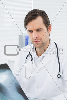Doctor looking at x-ray picture of lungs in medical office