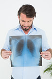 Smiling young man holding lung x-ray