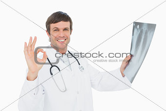 Smiling male doctor holding an x-ray picture of lungs