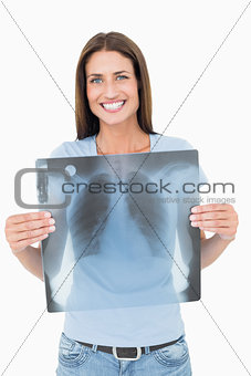 Portrait of a smiling young woman holding lung x-ray