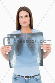 Portrait of a serious young woman holding lung x-ray