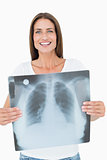 Portrait of a smiling young woman holding lung x-ray
