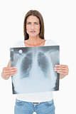 Portrait of a serious young woman holding lung x-ray