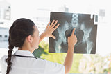 Rear view of a female doctor examining xray