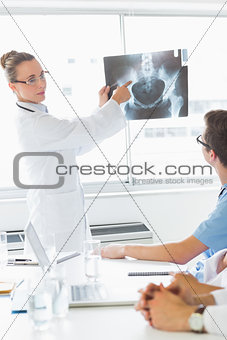 Professional doctor showing Xray to colleagues