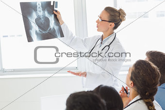 Doctor and colleagues examining Xray