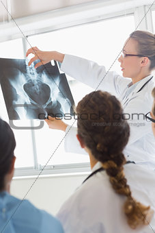 Doctor discussing medical Xray with colleagues