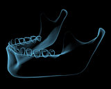 Human jaw x-ray blue transparent isolated on black
