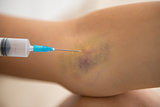 Closeup on drug addict young woman making injection