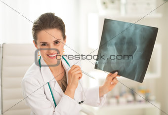Portrait of happy medical doctor woman holding fluorography