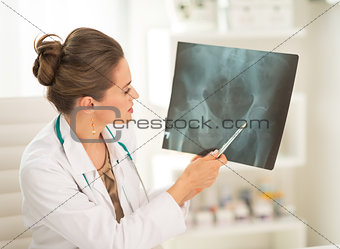 Medical doctor woman pointing on fluorography