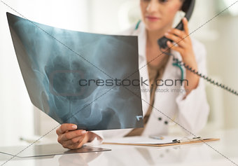 Closeup on medical doctor woman looking on fluorography and talk