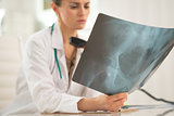 Closeup on medical doctor woman with phone looking on fluorograp