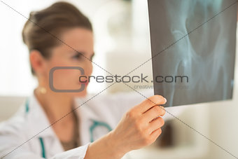 Closeup on medical doctor woman looking on fluorography