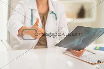Closeup on medical doctor woman with fluorography showing thumbs