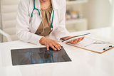 Closeup on medical doctor woman with fluorography using tablet p