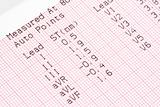 cardiographical test results