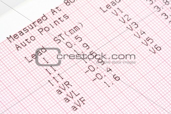 cardiographical test results