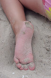 Sand foot