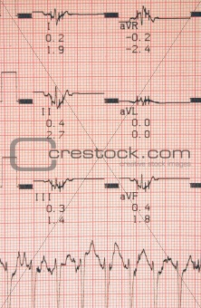 cardiological tests results