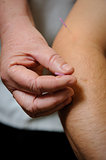 Acupuncture. Needles being inserted into a patient's skin