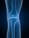 x-ray knee