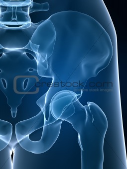 x-ray hip