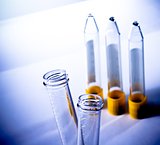 detail of the test tubes in laboratory on table