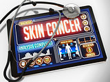 Skin Cancer on the Display of Medical Tablet.
